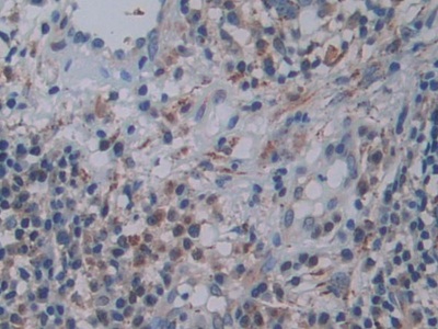 Polyclonal Antibody to Family With Sequence Similarity 3, Member C (FAM3C)