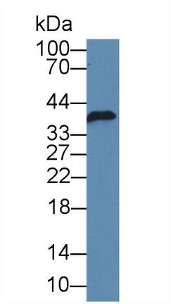 Polyclonal Antibody to FK506 Binding Protein Like Protein (FKBPL)