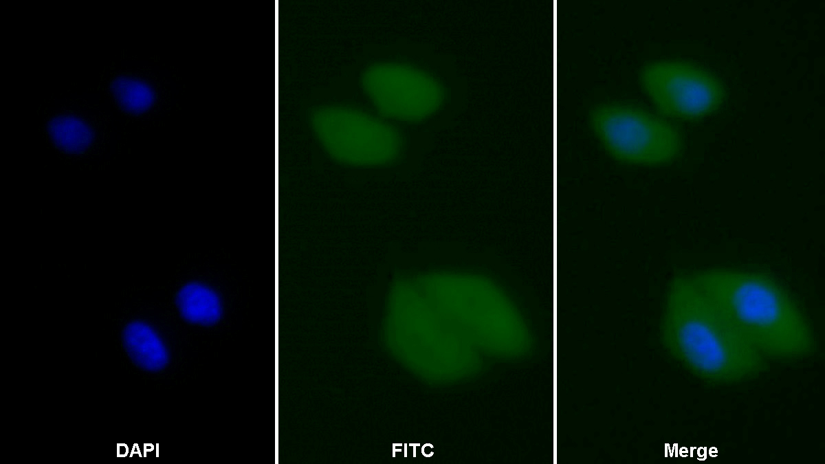 Polyclonal Antibody to FK506 Binding Protein Like Protein (FKBPL)