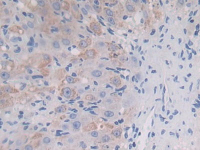 Polyclonal Antibody to Insulin Like Growth Factor 2 mRNA Binding Protein 2 (IGF2BP2)