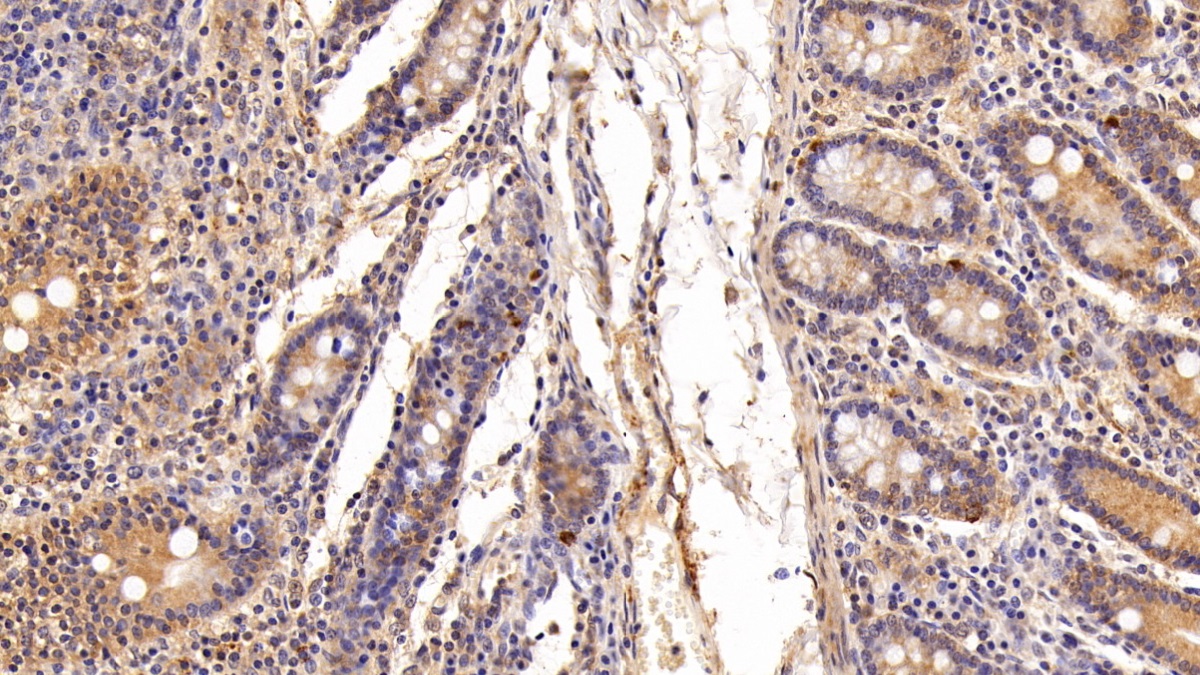 Polyclonal Antibody to Ubiquitin Cross Reactive Protein (UCRP)