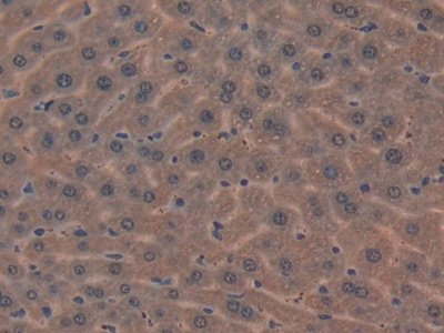 Polyclonal Antibody to Mindbomb Homolog 2 (MIB2)