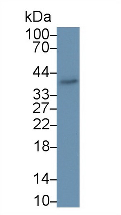 Polyclonal Antibody to Aminoacyl tRNA Synthetase Complex Interacting Multifunctional Protein 1 (AIMP1)