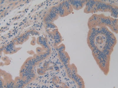 Polyclonal Antibody to Aminoacyl tRNA Synthetase Complex Interacting Multifunctional Protein 1 (AIMP1)