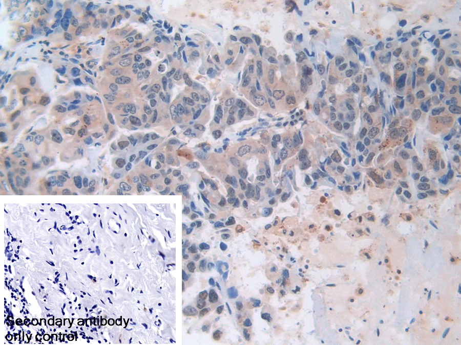 Polyclonal Antibody to Myxovirus Resistance 1 (MX1)