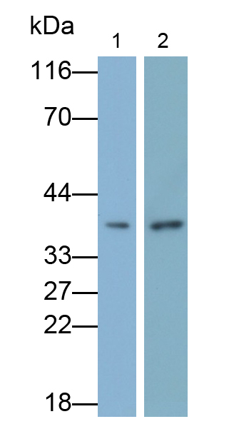 Polyclonal Antibody to Otubain 1 (OTUB1)