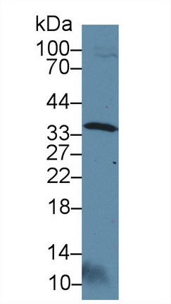 Polyclonal Antibody to Otubain 1 (OTUB1)