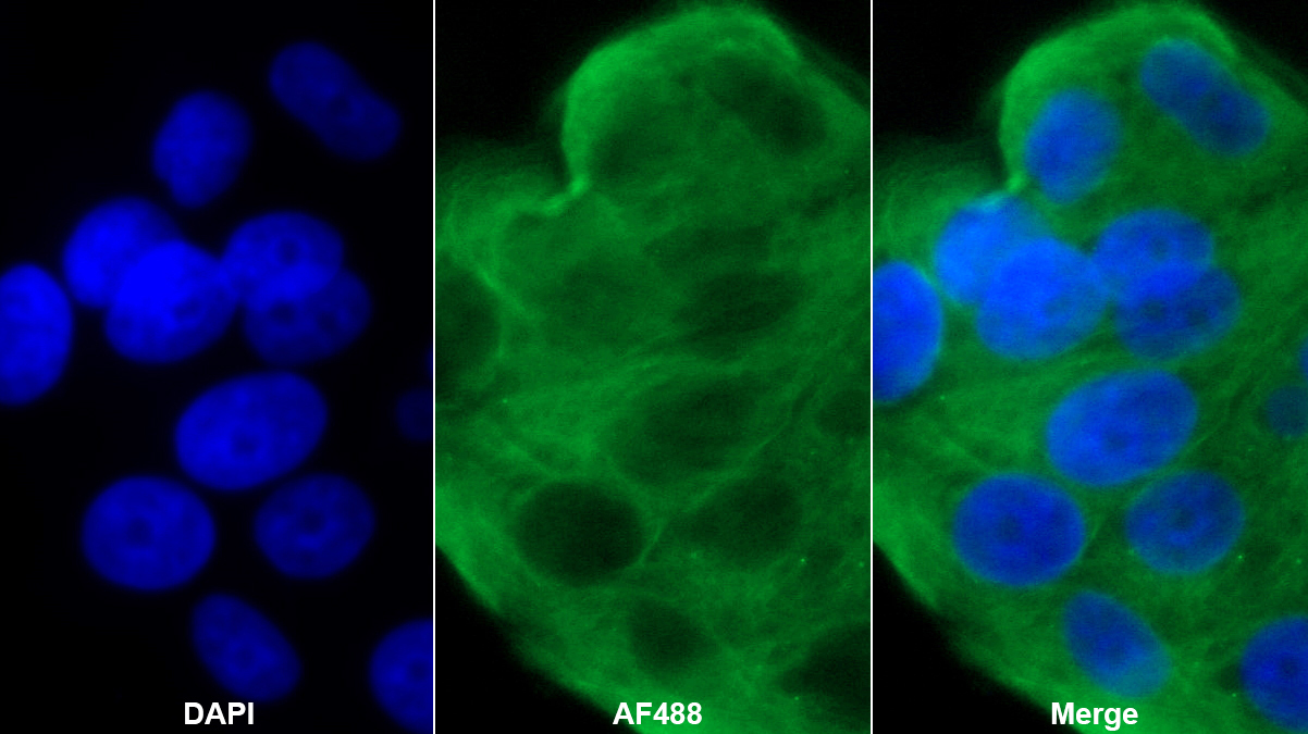 Polyclonal Antibody to Otubain 1 (OTUB1)