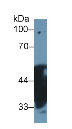 Polyclonal Antibody to N-myc Downstream Regulated Gene 2 (NDRG2)