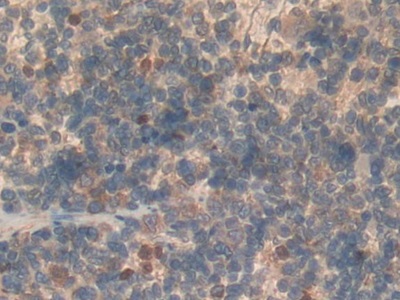 Polyclonal Antibody to Semaphorin 3A (SEMA3A)