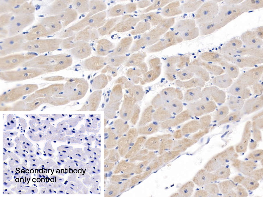 Polyclonal Antibody to Semaphorin 5B (SEMA5B)