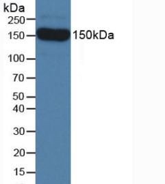 Polyclonal Antibody to Semaphorin 5B (SEMA5B)