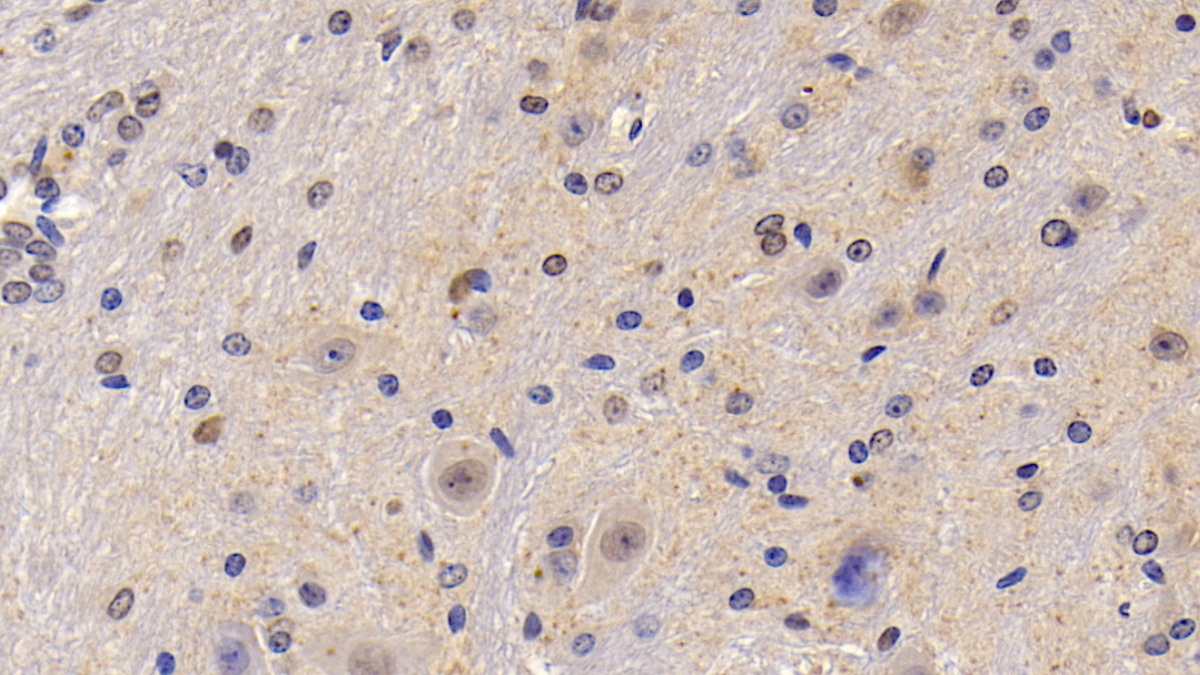 Polyclonal Antibody to Semaphorin 5B (SEMA5B)