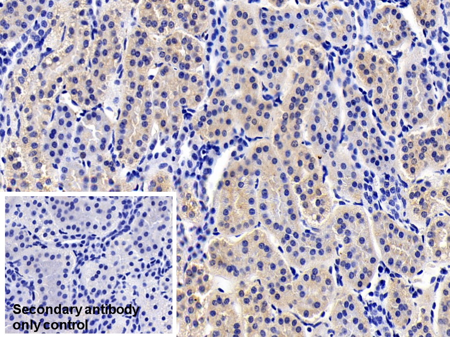 Polyclonal Antibody to Ribosomal Protein S6 Kinase Beta 1 (RPS6Kb1)