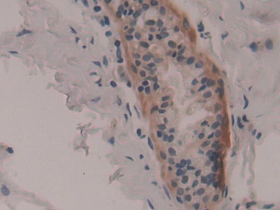 Polyclonal Antibody to Ribosomal Protein S6 Kinase Alpha 1 (RPS6Ka1)