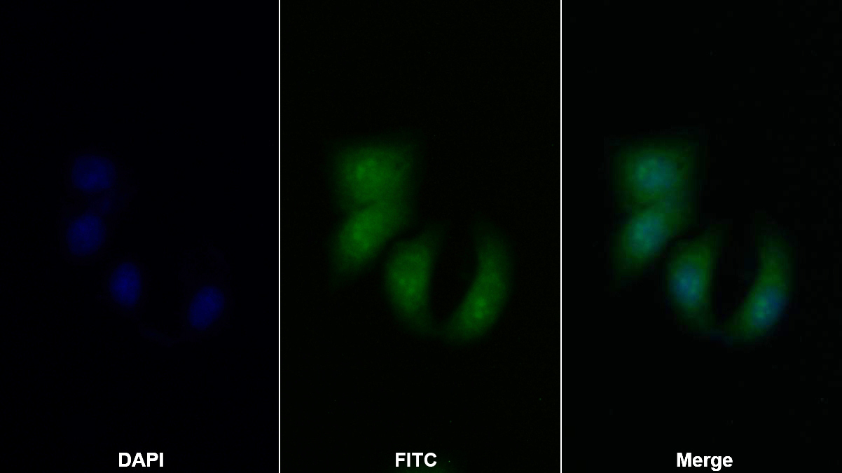 Polyclonal Antibody to Ribosomal Protein S6 Kinase Beta 2 (RPS6Kb2)
