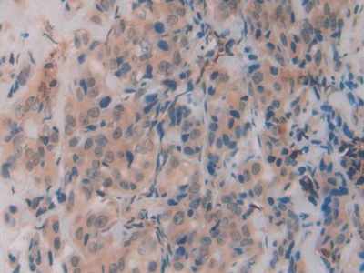 Polyclonal Antibody to R-Spondin 1 (RSPO1)