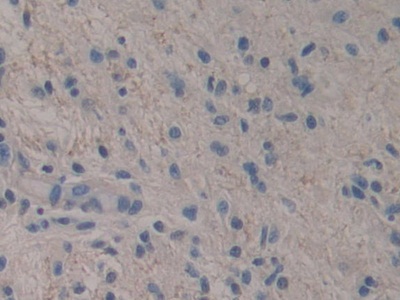 Polyclonal Antibody to R-Spondin 3 (RSPO3)