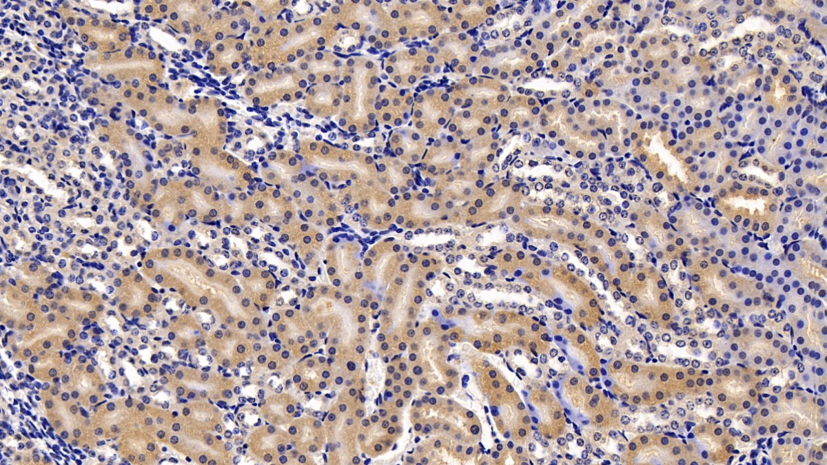 Polyclonal Antibody to Salt Inducible Kinase 2 (SIK2)
