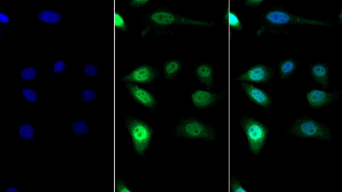 Polyclonal Antibody to Specificity Protein 1 (Sp1)