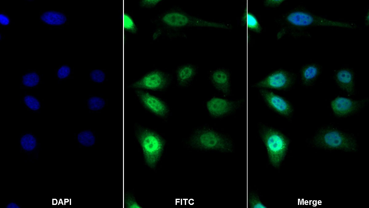 Polyclonal Antibody to Specificity Protein 1 (Sp1)