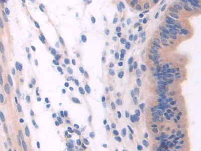 Polyclonal Antibody to Cytospin B (CYTSB)