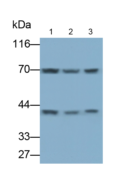 Polyclonal Antibody to Transformer 2 Beta (TRA2b)