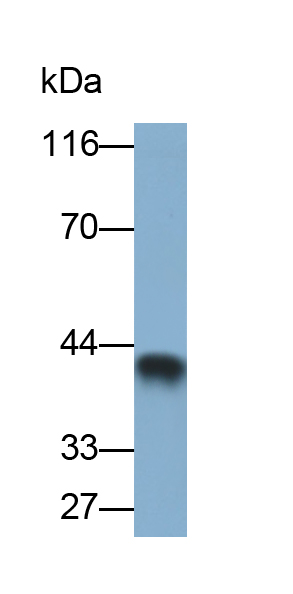 Polyclonal Antibody to Transformer 2 Beta (TRA2b)