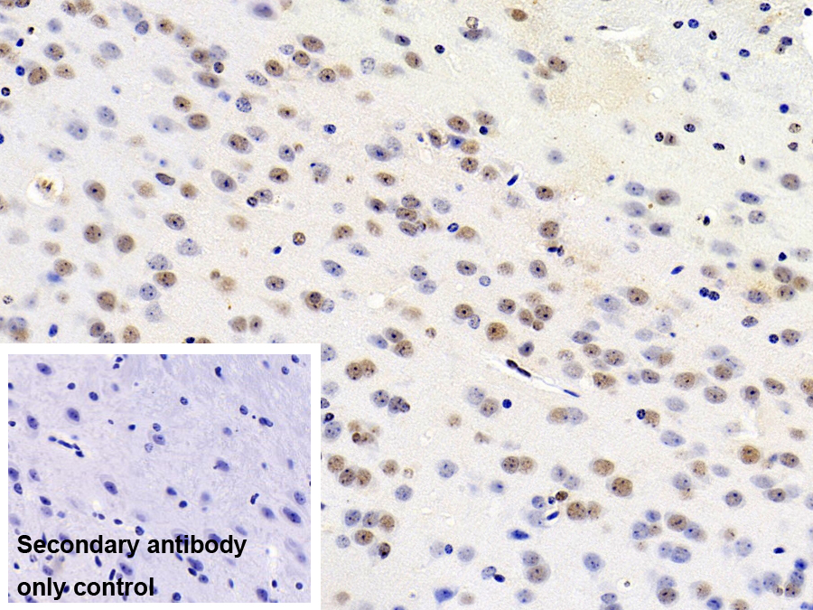 Polyclonal Antibody to Transformer 2 Beta (TRA2b)