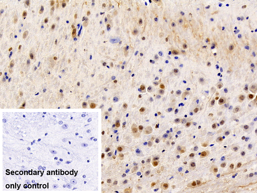 Polyclonal Antibody to Transformer 2 Beta (TRA2b)