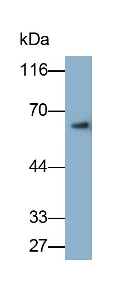 Polyclonal Antibody to Keratin 71 (KRT71)