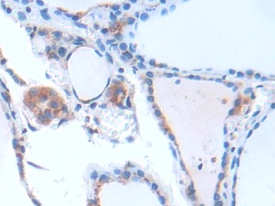 Polyclonal Antibody to G Protein Beta Subunit Like Protein (GbL)