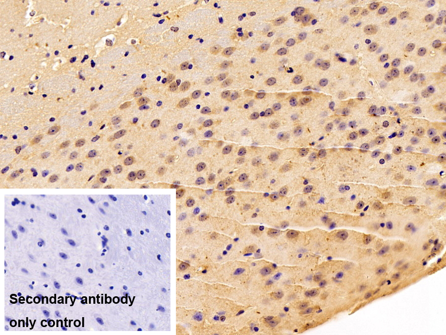 Polyclonal Antibody to BRCA1/BRCA2 Containing Complex Subunit 3 (BRCC3)