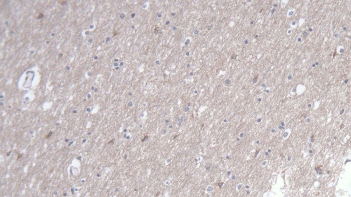 Polyclonal Antibody to Toll Interleukin 1 Receptor Domain Containing Adaptor Protein (TIRAP)