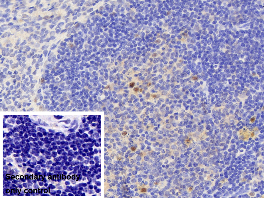 Polyclonal Antibody to Sp140 Nuclear Body Protein (SP140)