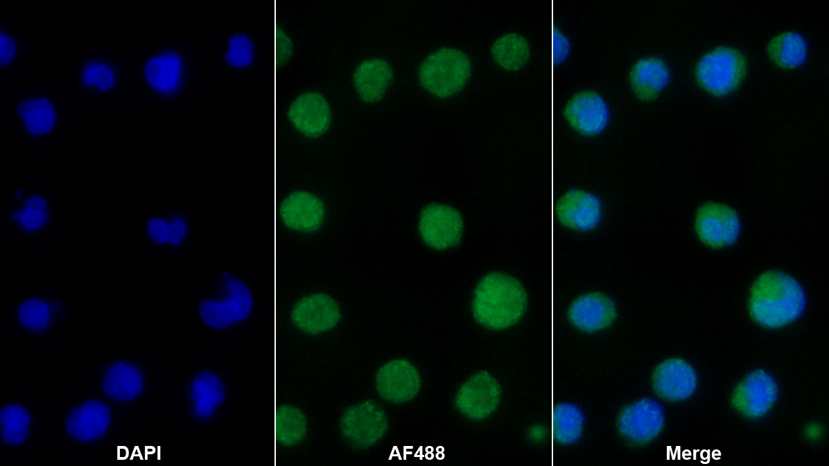 Polyclonal Antibody to Sp140 Nuclear Body Protein (SP140)