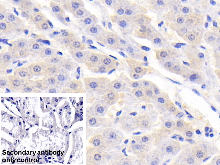 Polyclonal Antibody to Retinol Binding Protein 5, Cellular (RBP5)