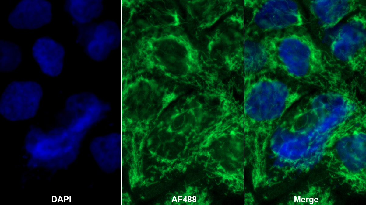 Polyclonal Antibody to Translocase Of Outer Mitochondrial Membrane 70A (TOMM70A)