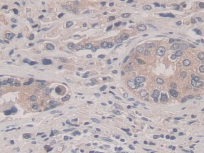 Polyclonal Antibody to Suppression Of Tumorigenicity 14 (ST14)