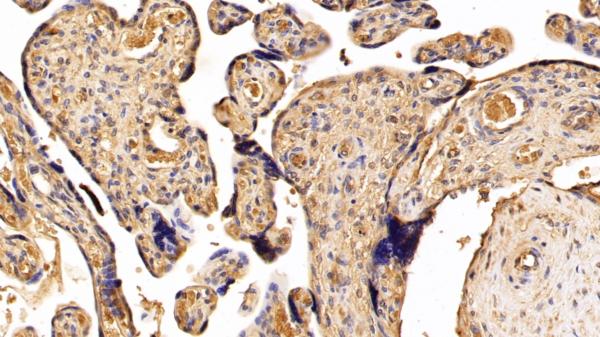 Polyclonal Antibody to Suppression Of Tumorigenicity 14 (ST14)