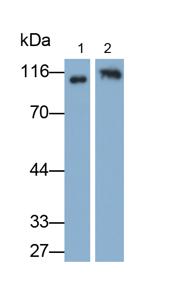 Polyclonal Antibody to Suppression Of Tumorigenicity 14 (ST14)