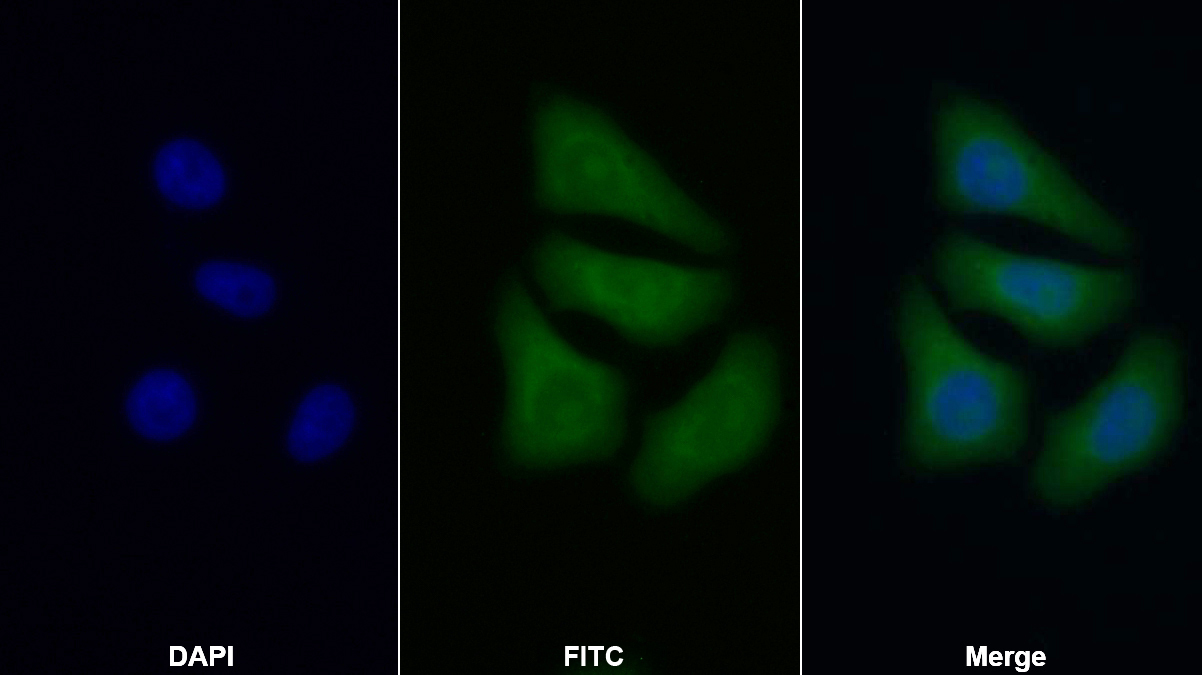 Polyclonal Antibody to Proteasome 26S Subunit, Non ATPase 8 (PSMD8)