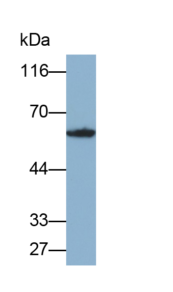 Polyclonal Antibody to MHC Class I Polypeptide Related Sequence A (MICA)