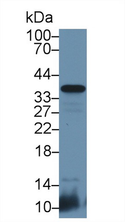 Polyclonal Antibody to Cluster Of Differentiation 8b (CD8b)