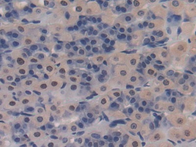 Polyclonal Antibody to Cluster Of Differentiation 8b (CD8b)