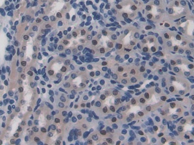 Polyclonal Antibody to Cluster Of Differentiation 8b (CD8b)