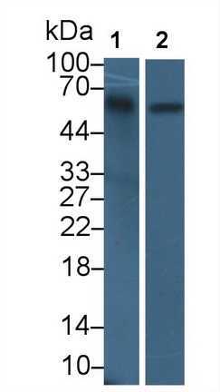 Polyclonal Antibody to Amylase Alpha 2B, Pancreatic (AMY2B)