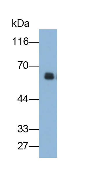 Polyclonal Antibody to Amylase Alpha 2B, Pancreatic (AMY2B)
