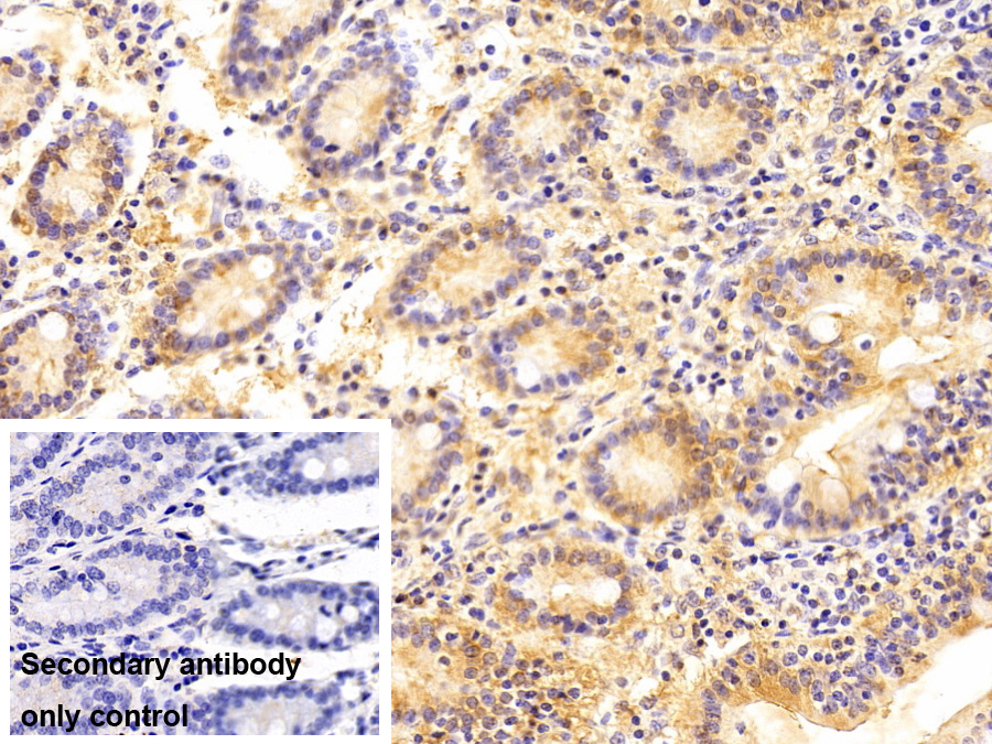Polyclonal Antibody to Dihydrodiol Dehydrogenase 2 (DDH2)