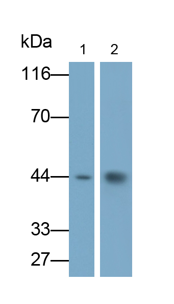 Polyclonal Antibody to Melanoma Antigen Family A3 (MAGEA3)